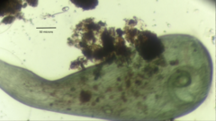 Stentor coeruleus