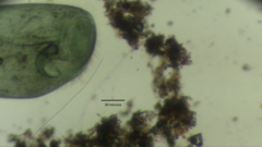 Stentor coeruleus