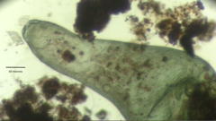 Stentor coeruleus