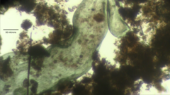 Stentor coeruleus