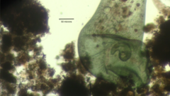 Stentor coeruleus