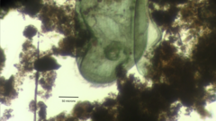 Stentor coeruleus