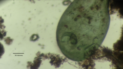 Stentor coeruleus