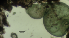 Stentor coeruleus