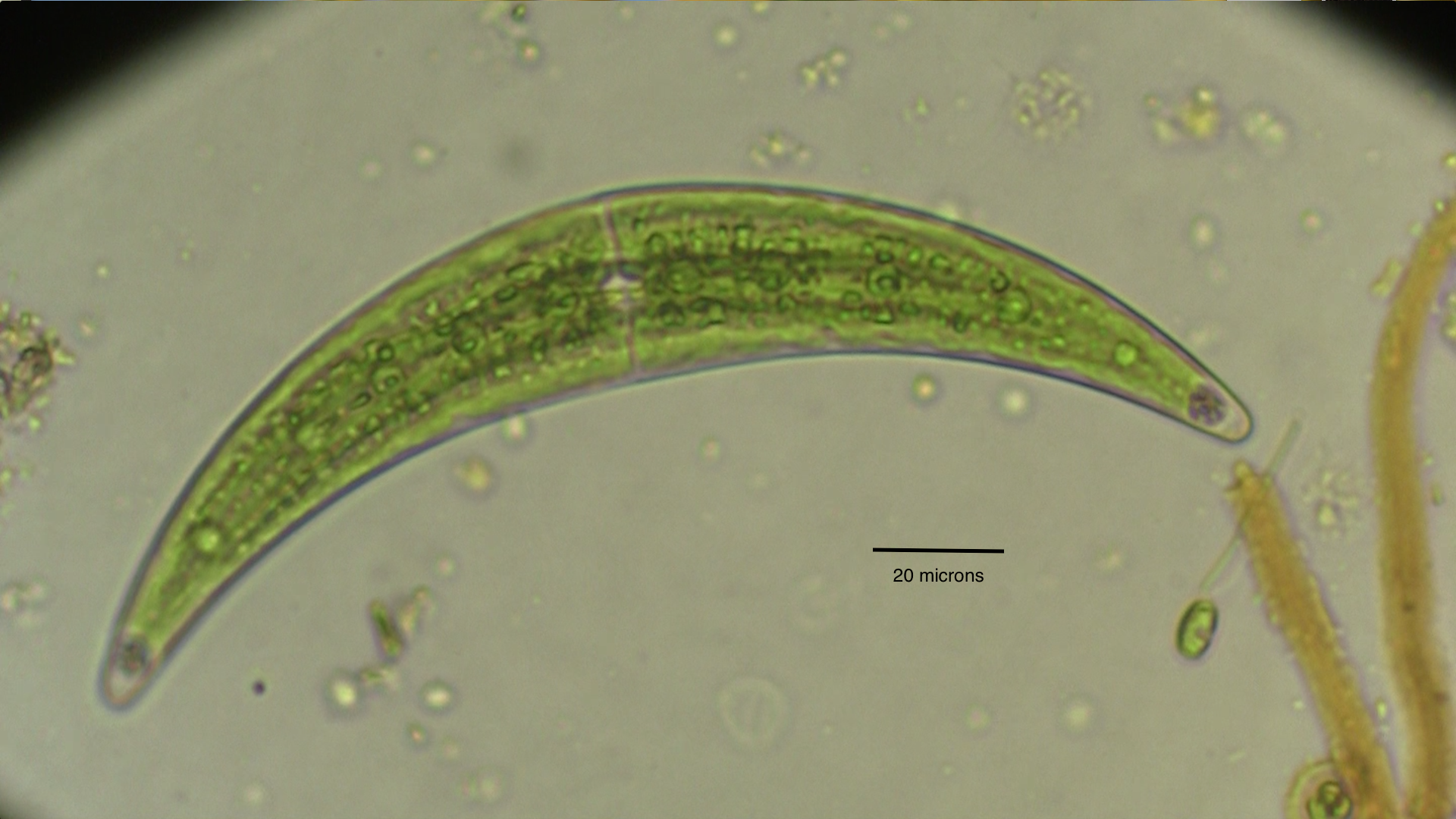 Closterium moniliferum