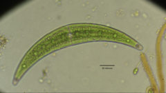Closterium moniliferum