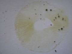 Chlorophyllum