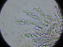 Pronectria robergei