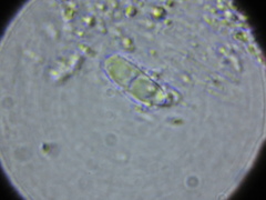Pronectria robergei