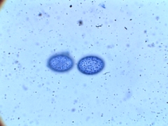 Scutellinia nigrohirtula image