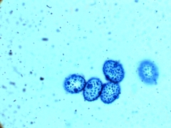 Scutellinia umbrorum image