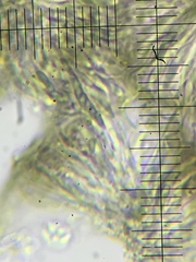 Mycocalicium subtile