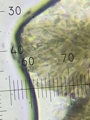 Mycocalicium subtile