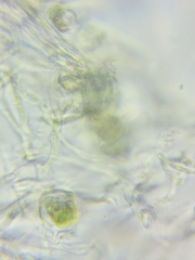 Trichopeziza