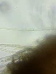 Trichopeziza