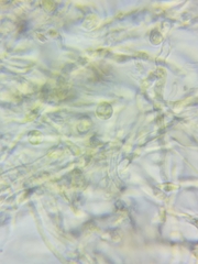 Trichopeziza