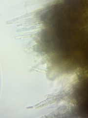 Trichopeziza