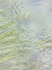 Trichopeziza