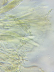 Trichopeziza