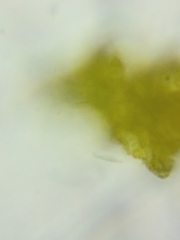 Trichopeziza