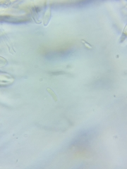 Trichopeziza