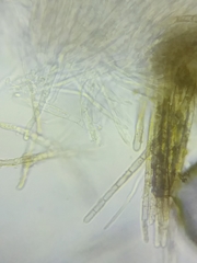 Trichopeziza