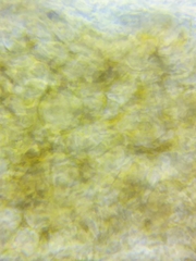 Trichopeziza