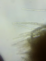 Trichopeziza