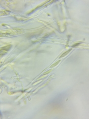 Trichopeziza