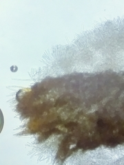 Trichopeziza
