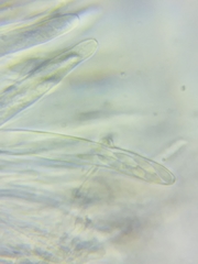 Trichopeziza