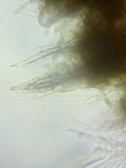 Trichopeziza