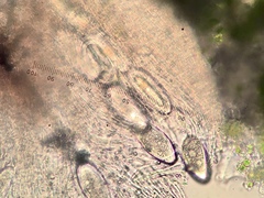 Pertusaria superiana