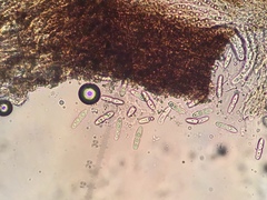 Constrictolumina cinchonae