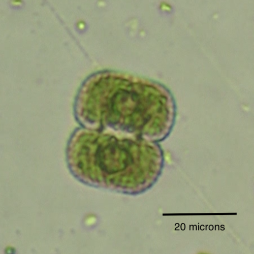 Cosmarium anisochondrum