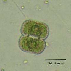 Cosmarium anisochondrum