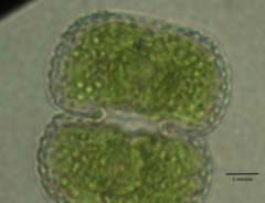 Cosmarium anisochondrum