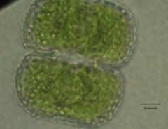 Cosmarium anisochondrum