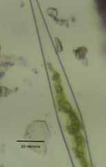 Closteriopsis longissima
