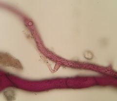 Bryum ruderale