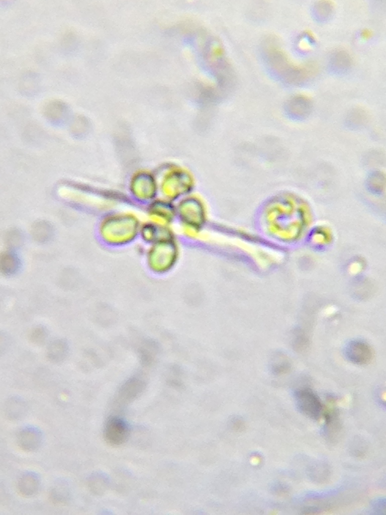 Ophiocytium arbuscula from Comox Valley, BC, Canada on June 22, 2023 at ...