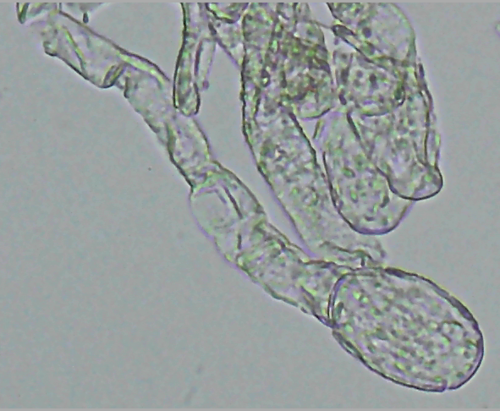 Nettle Powdery Mildew