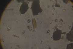 Cymbella