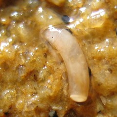Caecum