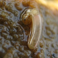Caecum