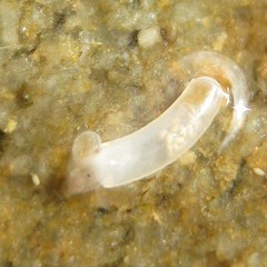 Caecum