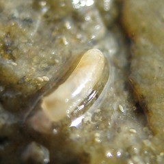 Caecum