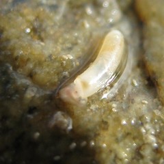 Caecum