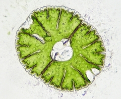 Micrasterias denticulata