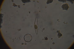Cymbella